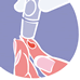 Diabetes mellitus – Definition, Formen, Zielwerte